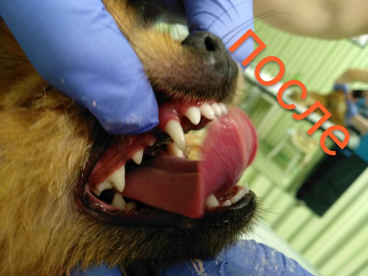 Ультразвуковая чистка зубов в стоматологии от камня, налета и желтизны и налета гна зубах.