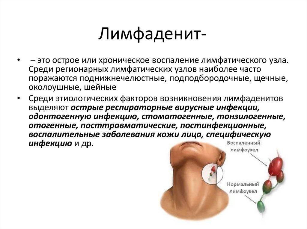 Диагностика заболеваний по языку: грибковые и бактериальные инфекции, обезвоживание, диабет и др. патологии
