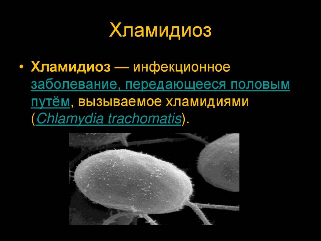 Хламидиоз влияние. Хламидиоз клинические проявления.