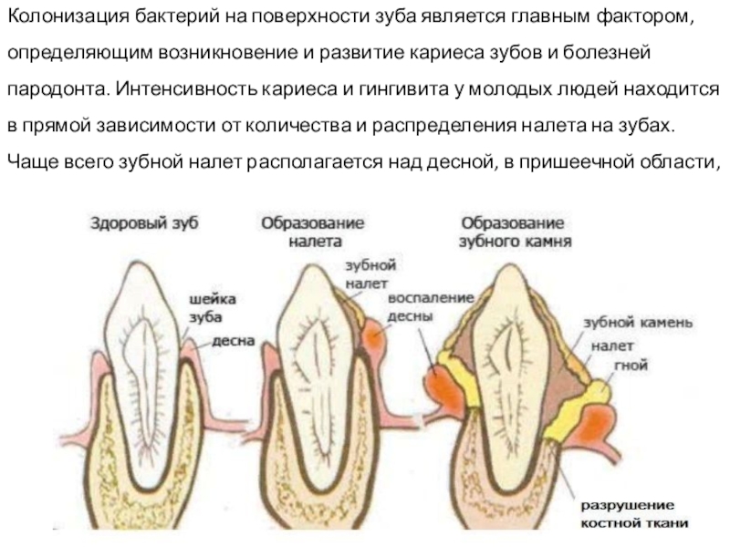 Как убрать зубной камень у кошки – лечение и удаление