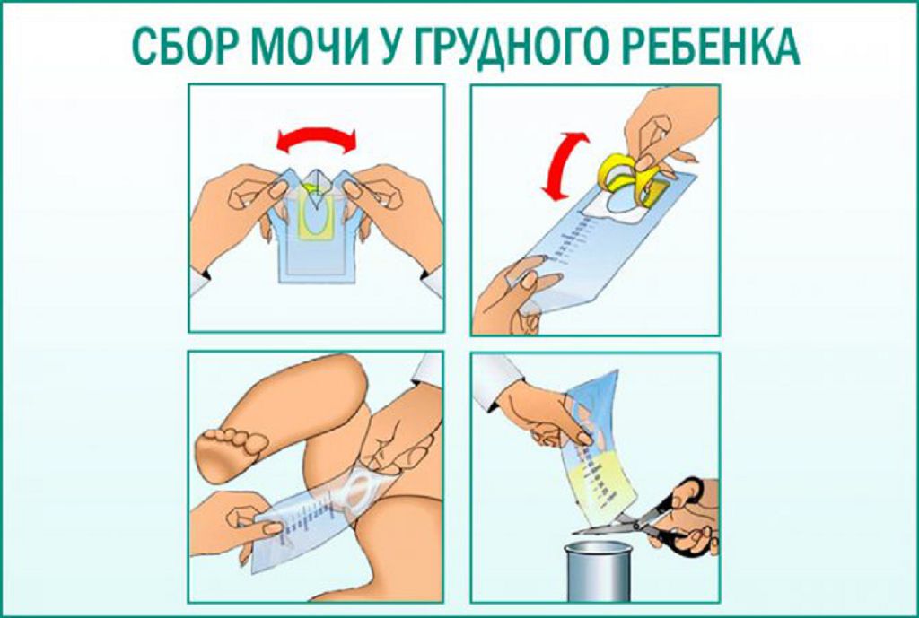 Как собрать мочу на анализ у кошек и собак