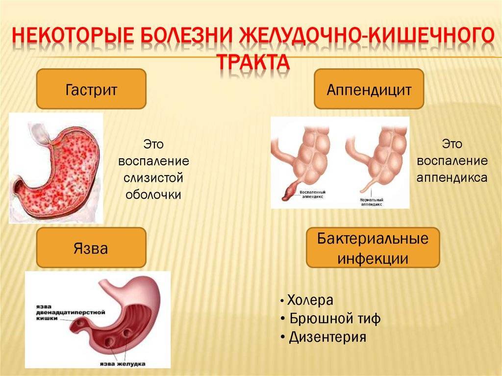 Заболевания желудочно кишечного тракта презентация