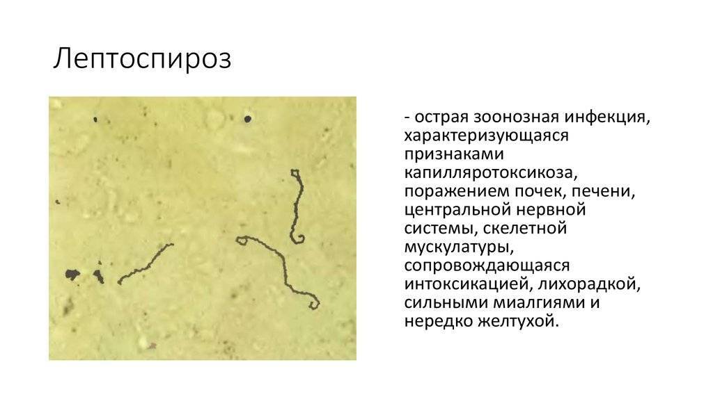 Лептоспироз | фбун «ростовский научно-исследовательский институт микробиологии и паразитологии» роспотребнадзора
