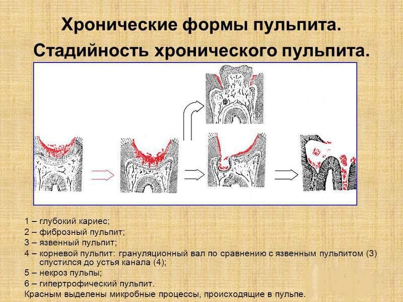 Воспаление слюнных желез. сиалоаденит