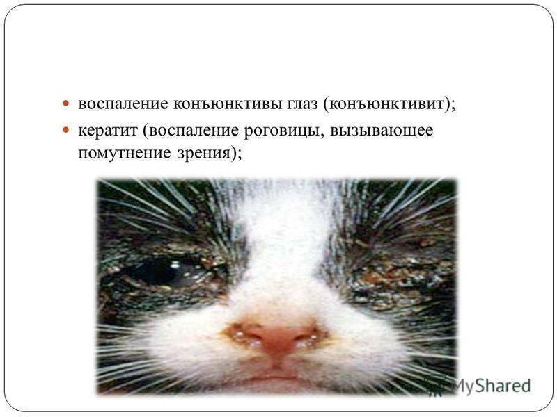 Бронхит у детей