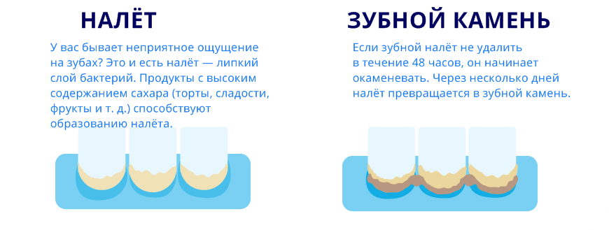Зубной камень у кошек: профилактика и удаление - как снять зубной камень у кота - kupipet.ru