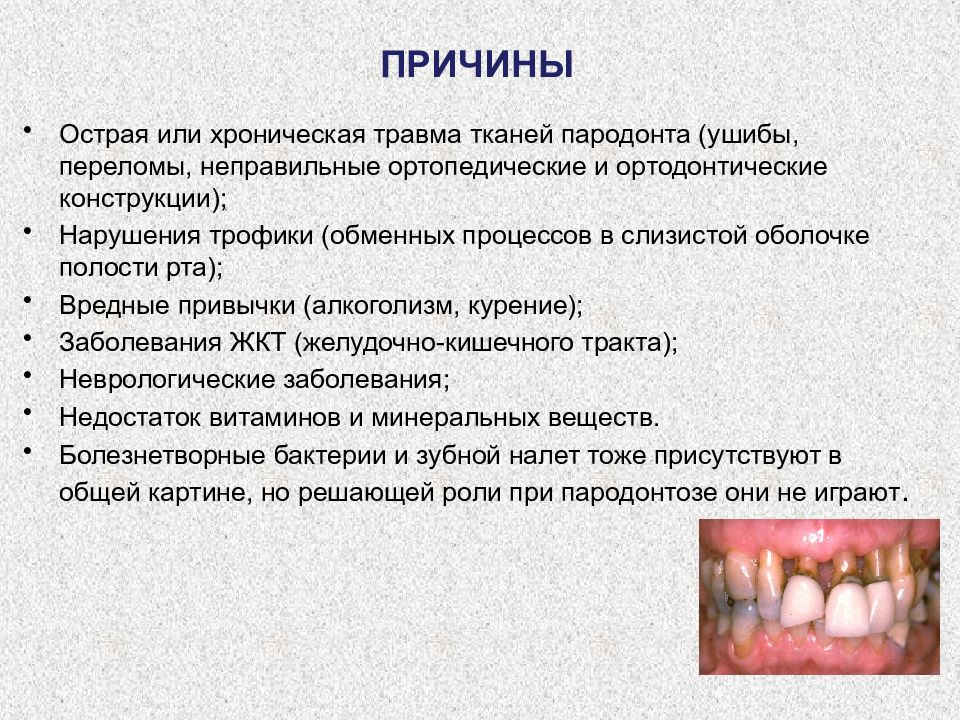 Пародонтолиз определение этиология классификация стадии макроскопическая картина осложнения и исходы