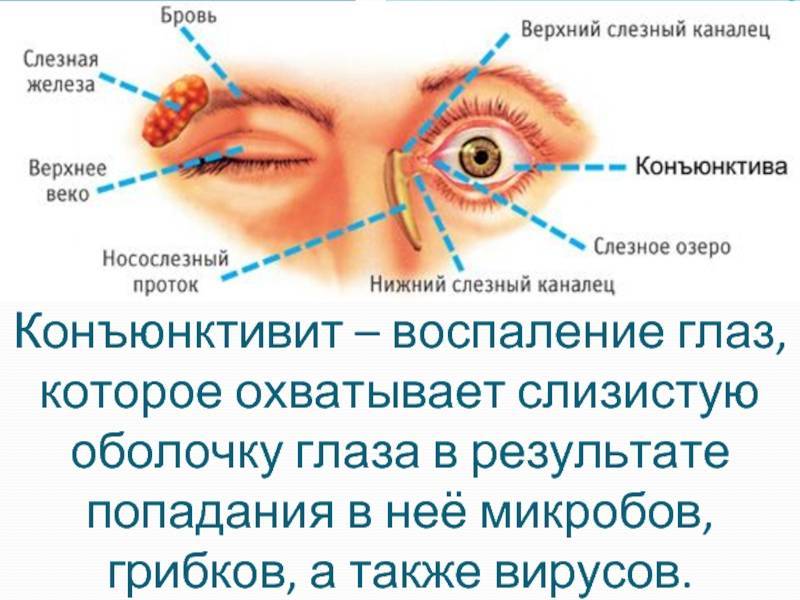 Симптомы и лечение болезней глаз у красноухих черепах