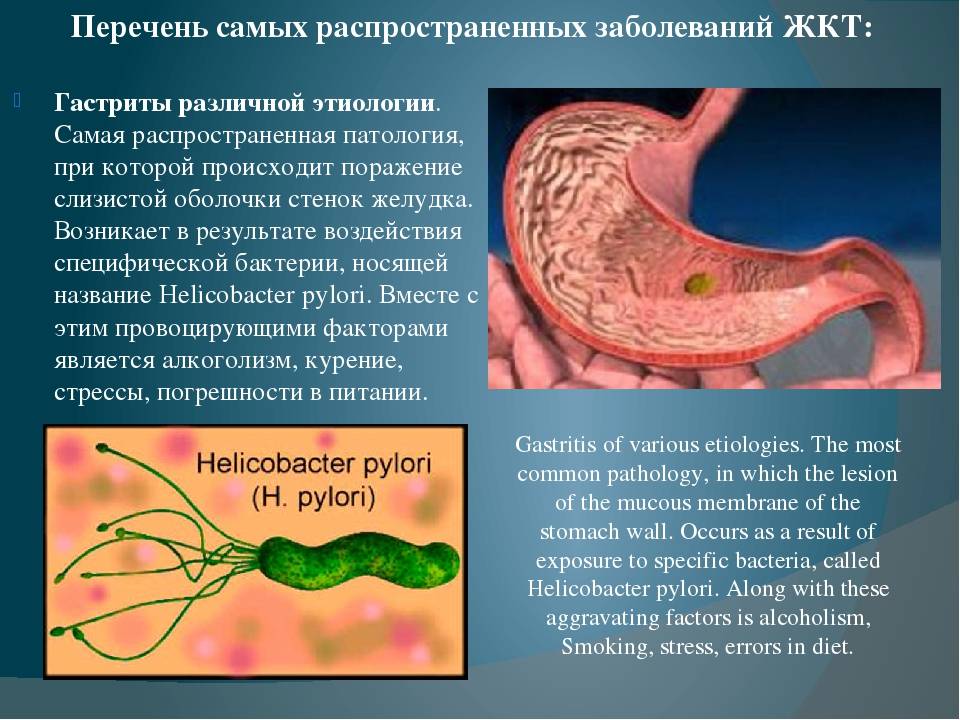 Острая кишечная инфекция у детей