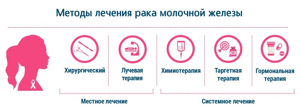 Гинекомастия у мужчин