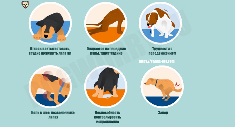 Пяточная шпора