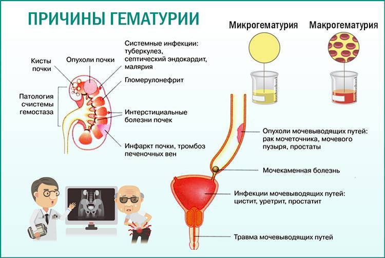 5 причин, почему у кота кровь в моче
