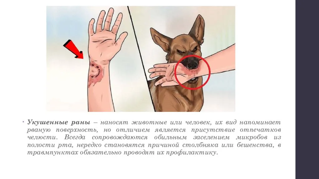 Что делать, если укусила собака: порядок действий, как возместить вред, куда обращаться