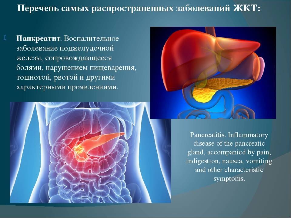 Профилактика заболеваний жкт презентация