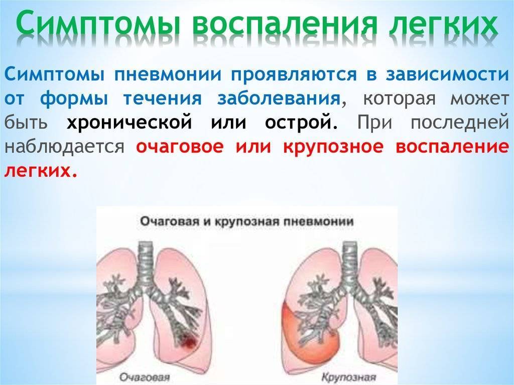 Острый и хронический трахеит - шарфом не обойтись