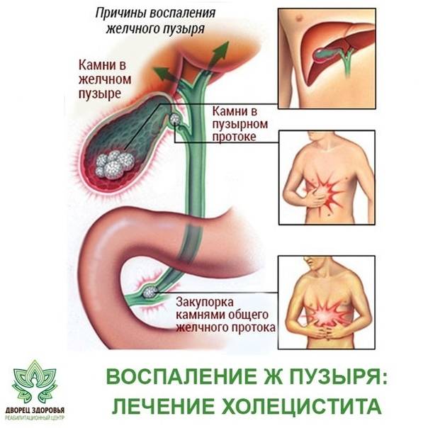 Холецистит у кошек: симптомы, почему постоянно рвет, лечение, питание и диета - блог о животных - zoo-pet.ru