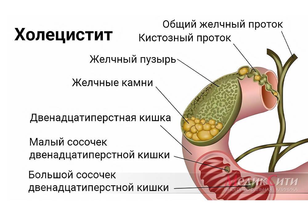 Холецистит у собак: симптомы, острый и хронический, схема лечения, чем кормить и какую диету соблюдать - блог о животных - zoo-pet.ru
