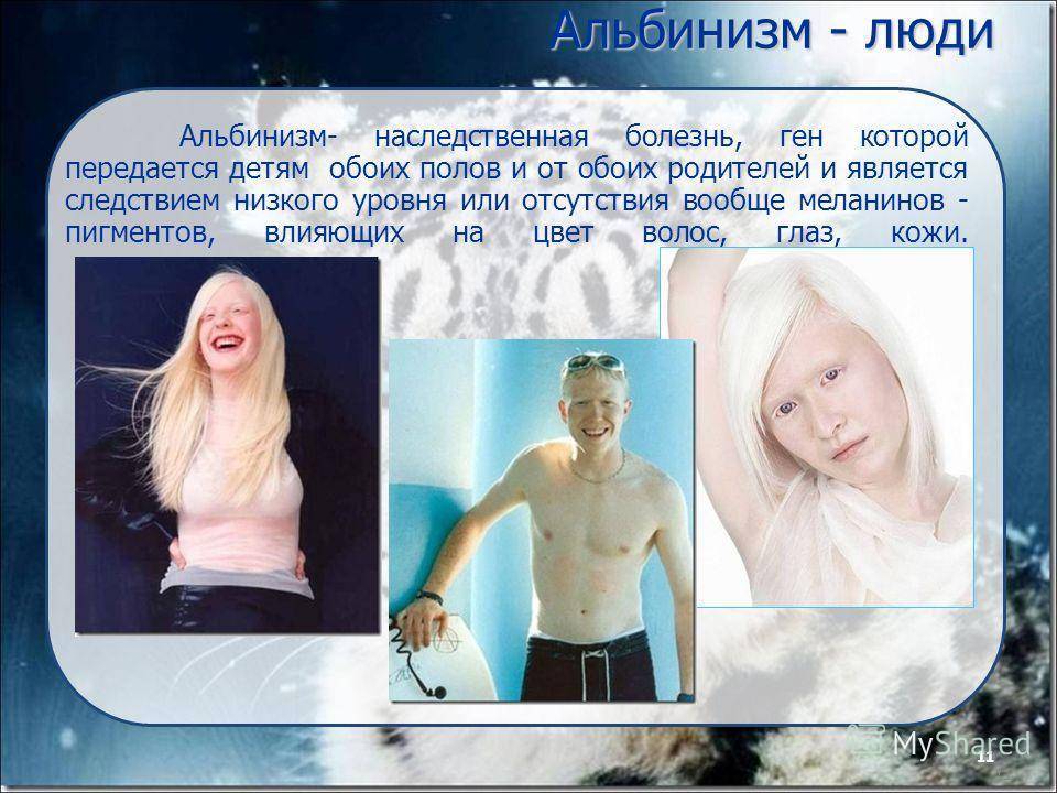 Характеристика породы доберман.