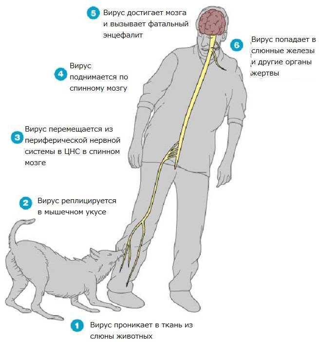 Бешенство у людей клиническая картина