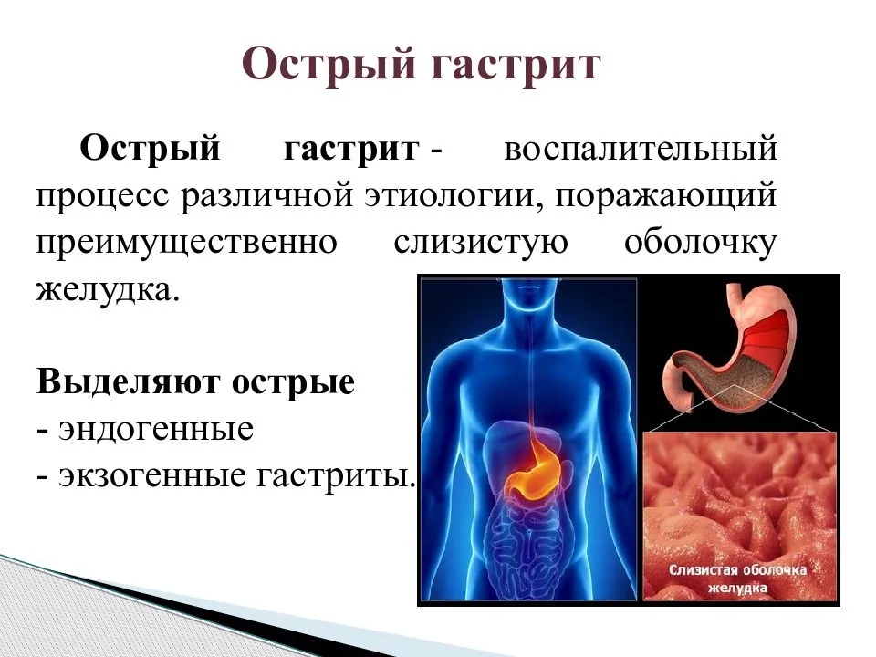 Профилактика заболеваний жкт презентация