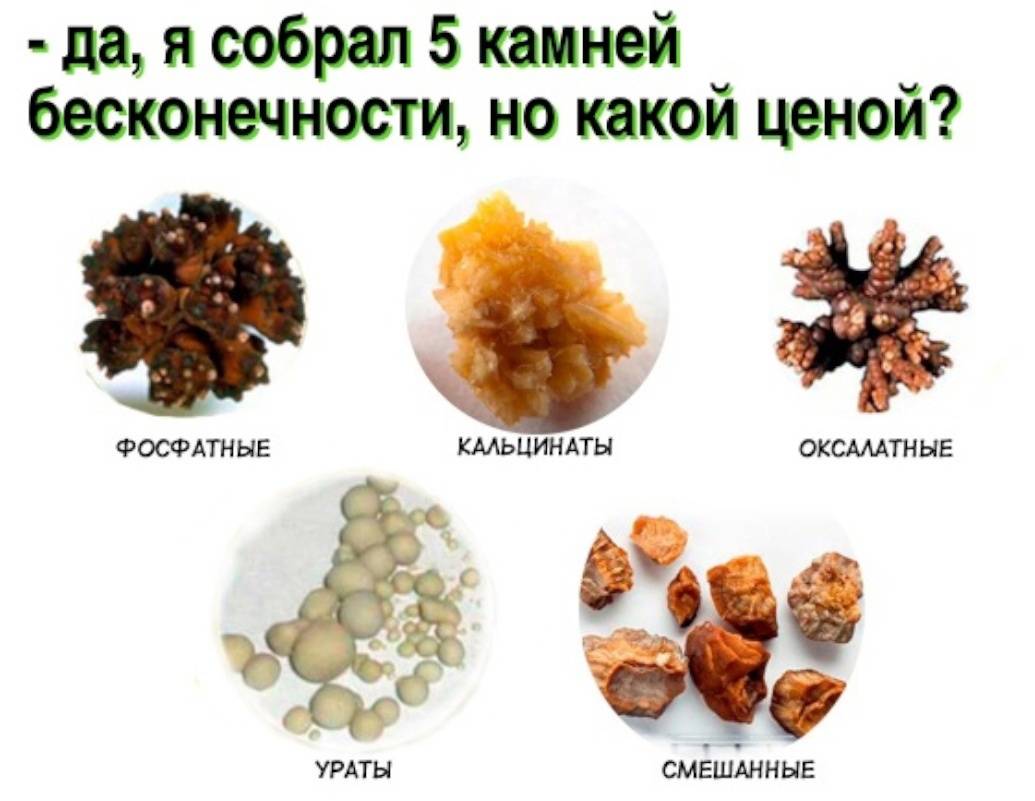 Мочекаменная болезнь у кошек: симптомы. лечение. профилактика