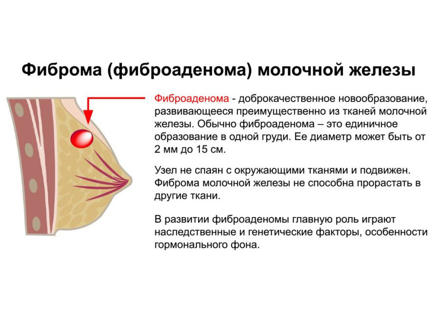 Схема лечения мастопатии форум