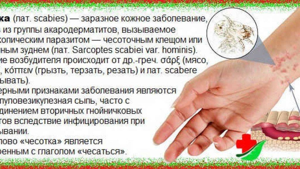 Узловая почесуха (нейродермит) — симптомы, диагностика, лечение разными методами
