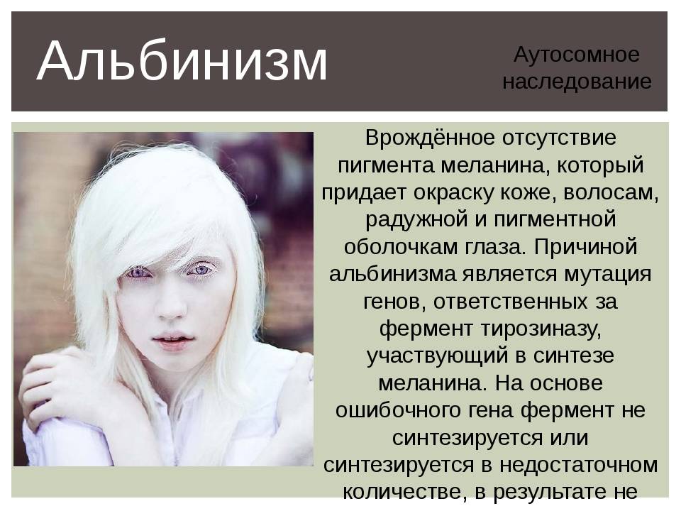 Белый доберман альбинос: особенности собак