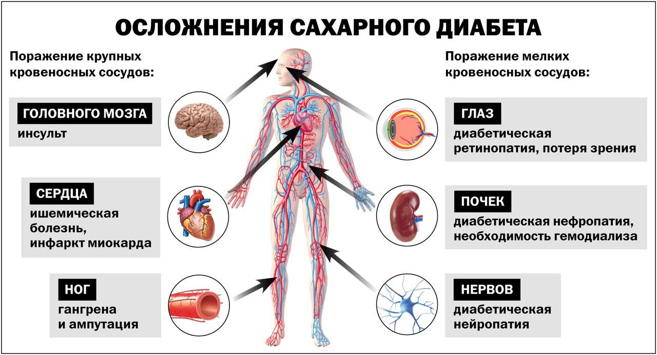 Сахарный диабет 1 и 2 типа презентация