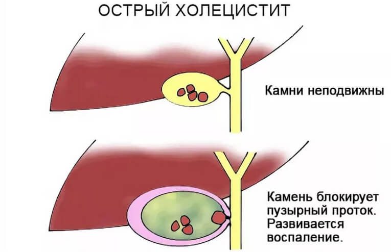 Холецистит у собак: причины, симптомы и этапы лечения