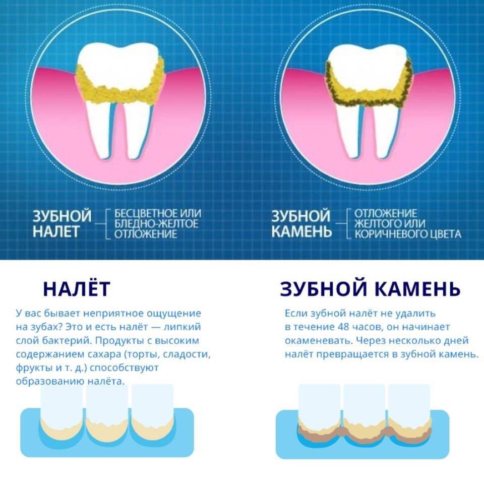 Зубной камень у кошек и котов - симптомы, лечение, препараты, причины появления | наши лучшие друзья