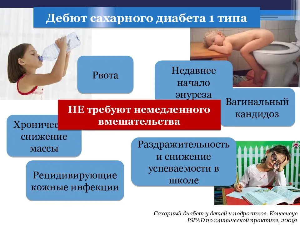 Полинейропатия