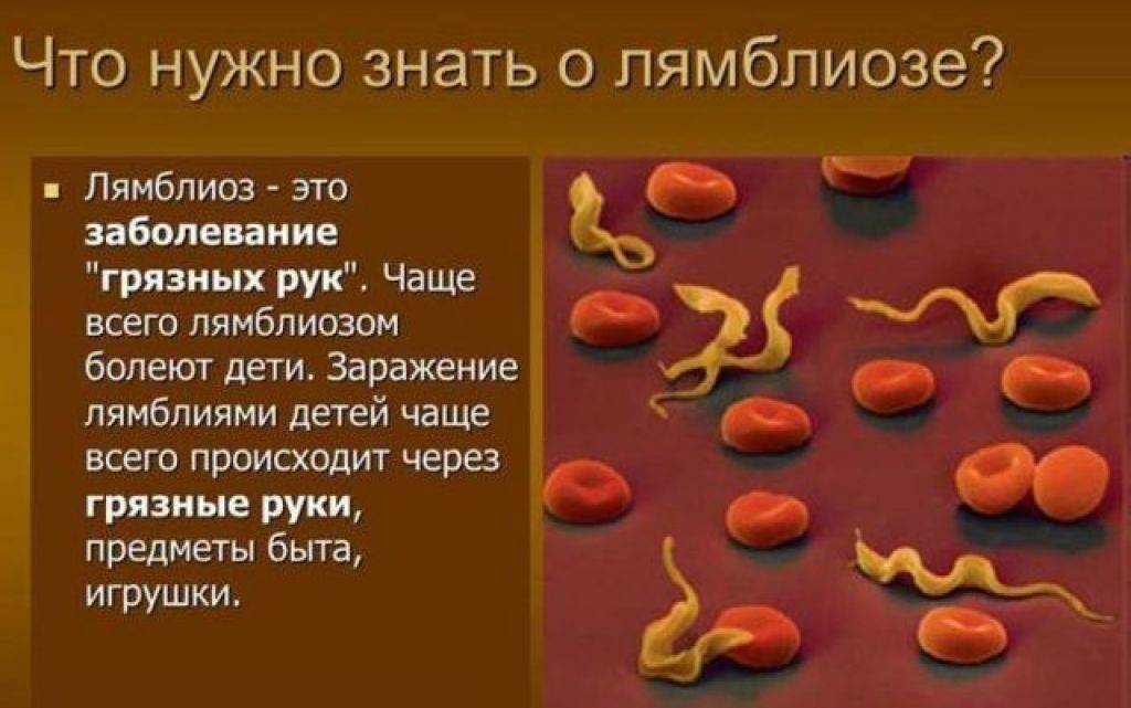 Лямблиоз