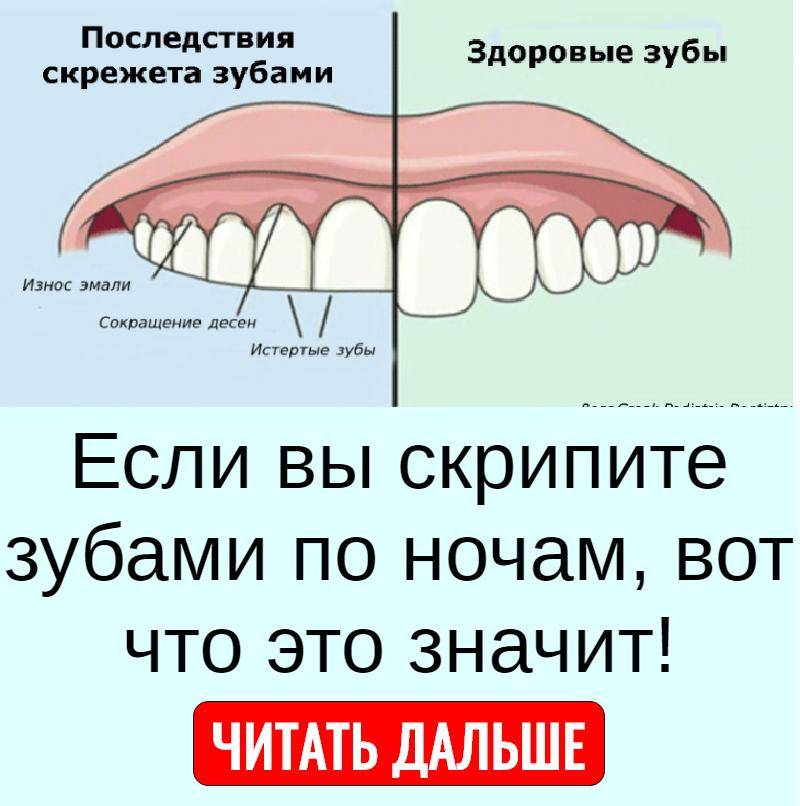 Зубы кролика: строение, количество, сроки появления, болезни зубов