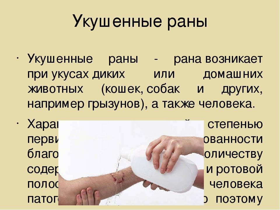 Укусила собака: что делать