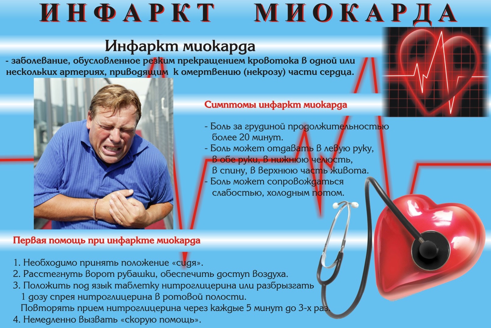 Инфаркт миокарда