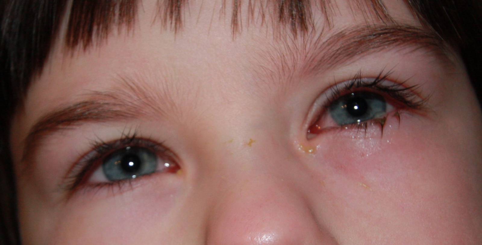 Болезни глаз у хомяков