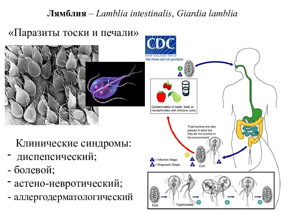 Картинка лямблии как выглядят