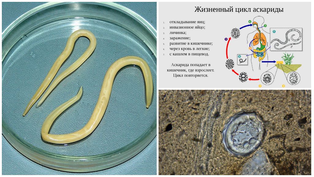 Какой цифрой обозначена на рисунке личинка аскариды в теле человека