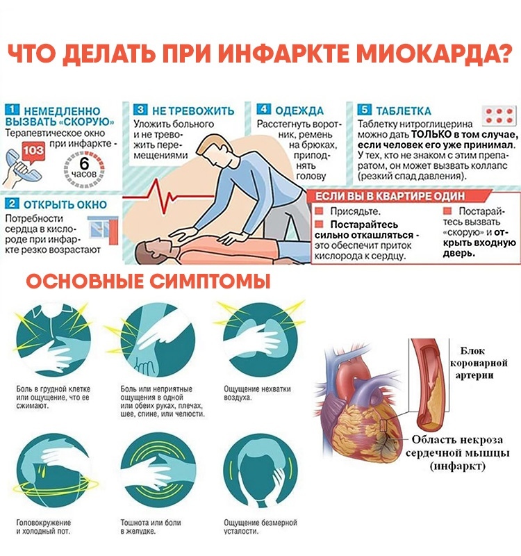 Инфаркт что чувствуешь