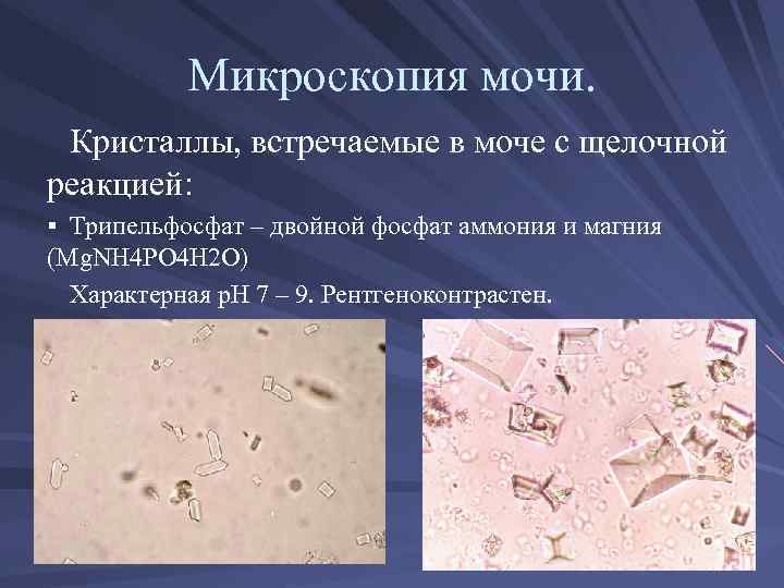 Мочекаменная болезнь у котов: симптомы, причины и лечение