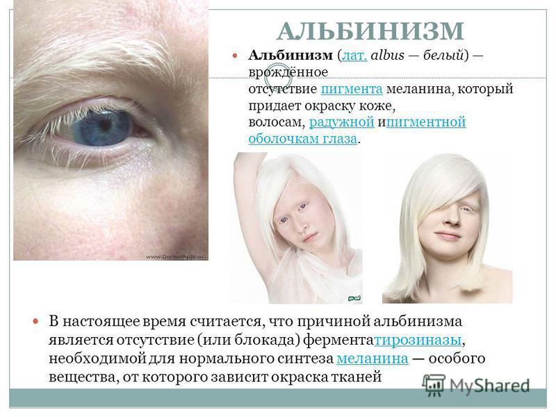Моя собака альбинос? характеристика собак-альбиносов — сайт эксперта по животным — howmeow