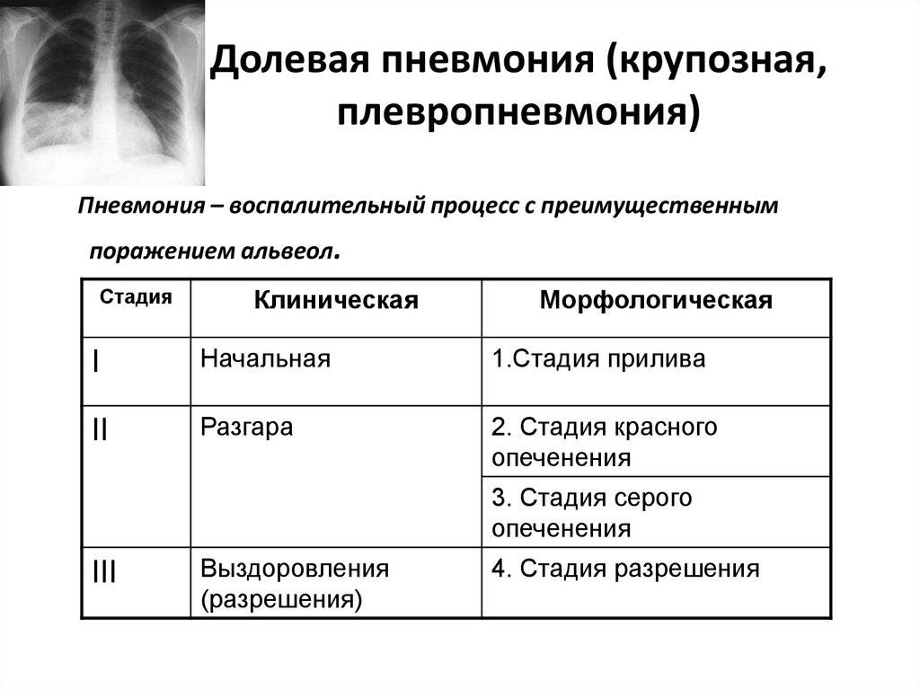 Пневмония у кошек: симптомы, опасность состояния, в каких условиях проводится лечение