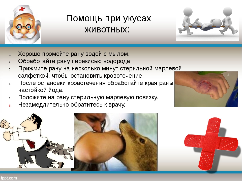 Укусы кошек: чем опасны и как лечить