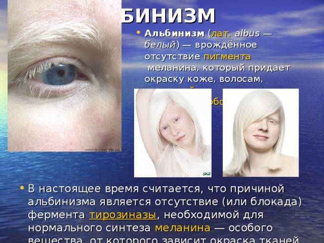 Белые доберманы: индивидуальные особенности и характер. доберман-альбинос :: syl.ru