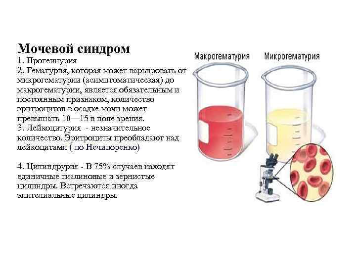 Кровь в моче у кошки, кота или котенка, частое мочеиспускание: причины, диагностика и лечение