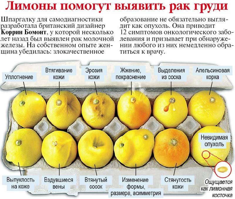 Рак молочной железы: первые признаки и симптомы рака груди, причины появления и стадии опухоли молочной железы | клиники «евроонко»