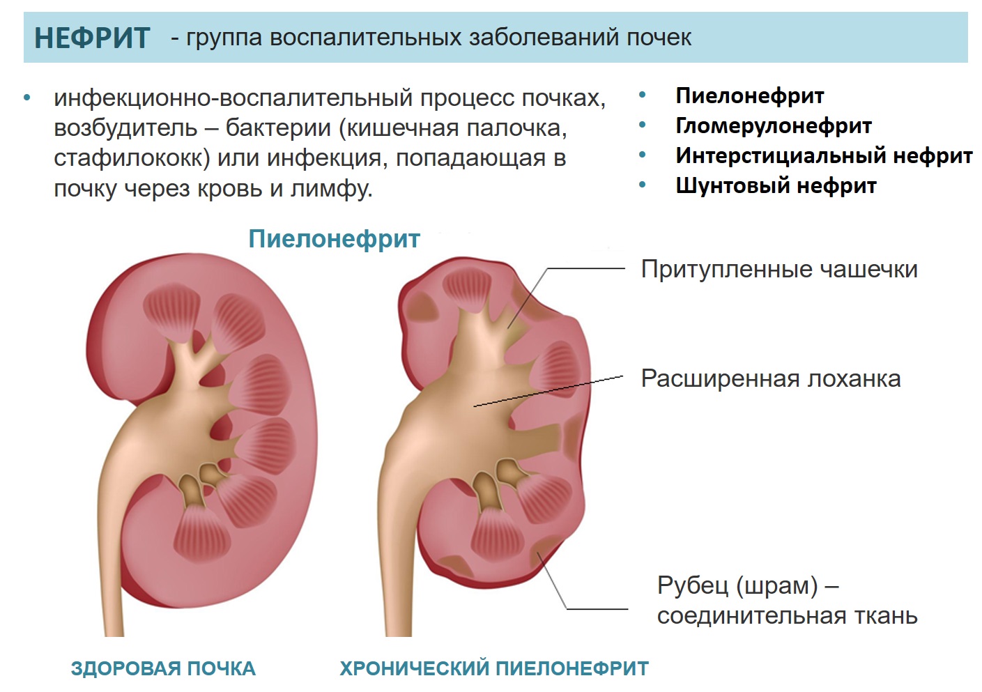 Болезни почек у кошек. хроническая болезнь почек (хбп).