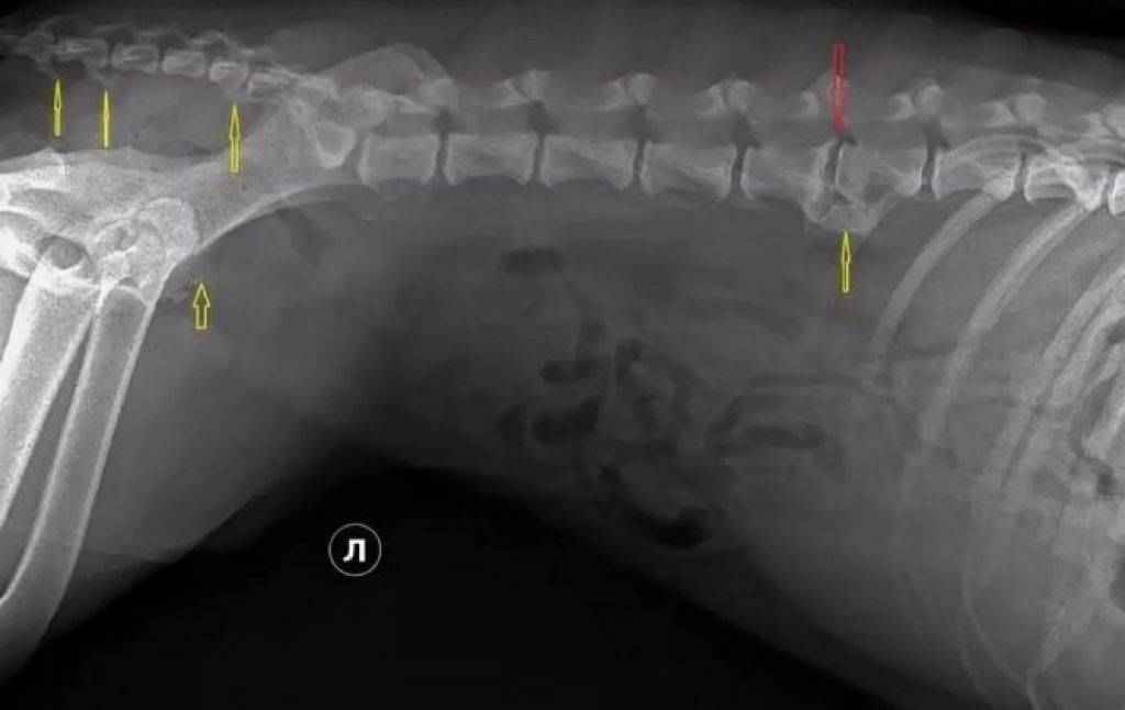 Клинический осмотр и анамнез