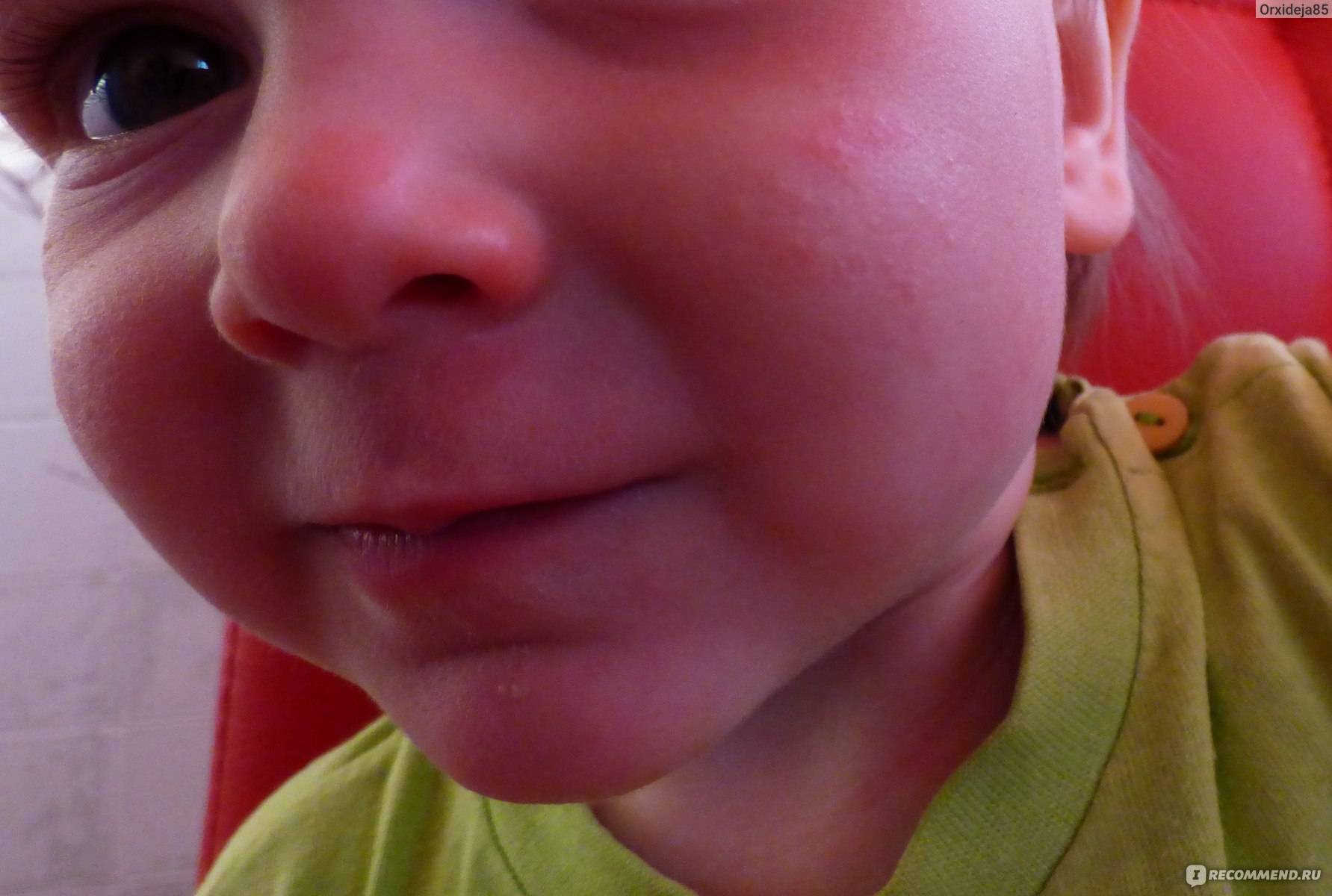 Бывает ли аллергия на хомяков? ребенок стал ужасно кашлять - я happy mama